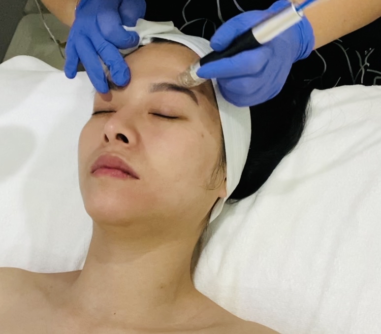 Hydrodermabrasion Facial