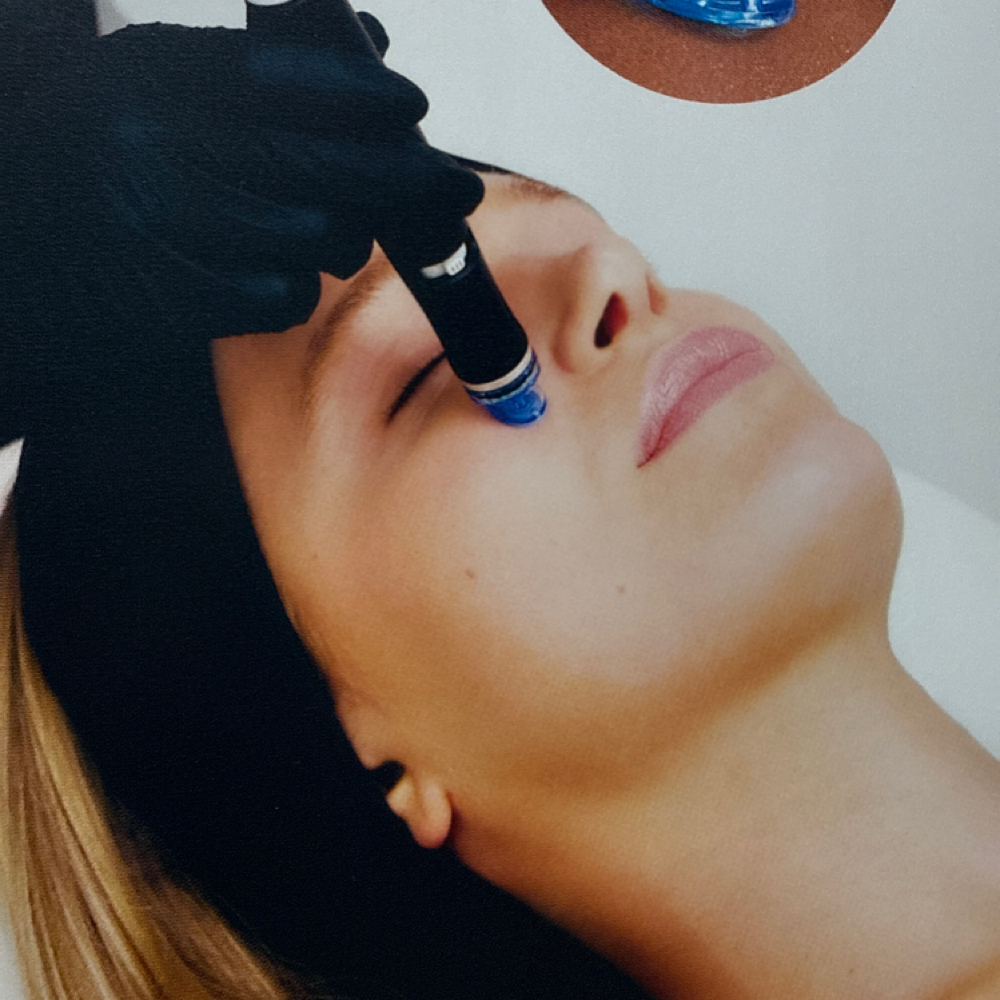 Signature Hydrafacial at SKIN by Christine Russell in Green Bay, WI