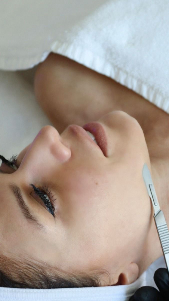 Add-ons ( Dermaplaning)