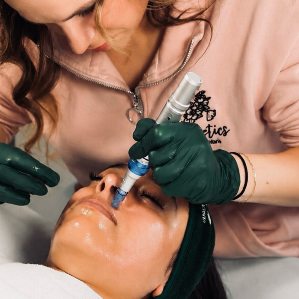 Microneedling at Esthetics by Eleyna Marie LLC in Mooresville, IN