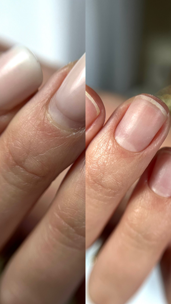 E-file Manicure W/removal