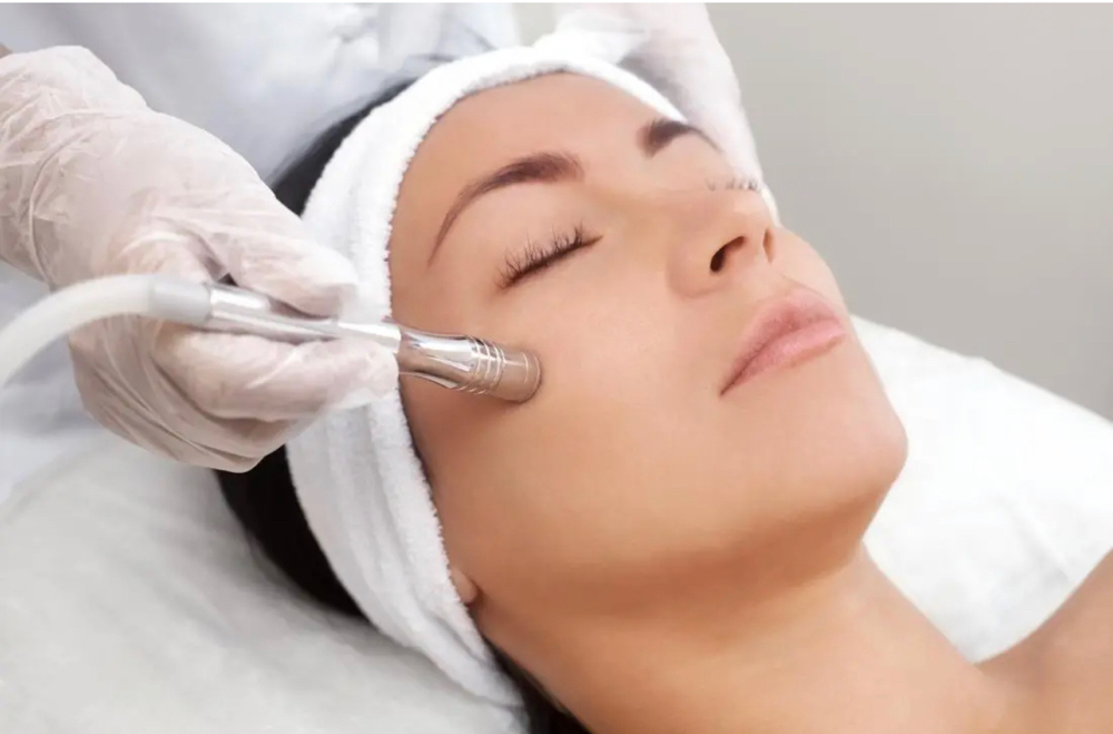 Microdermabrasion Facial