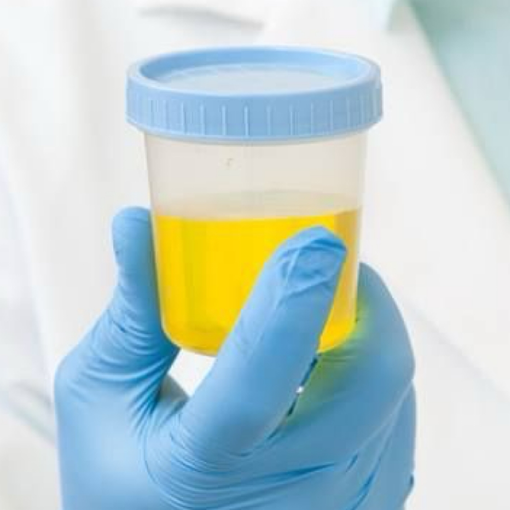 DOT URINE at Precision skin and Wellness Lab in Tallahassee, FL