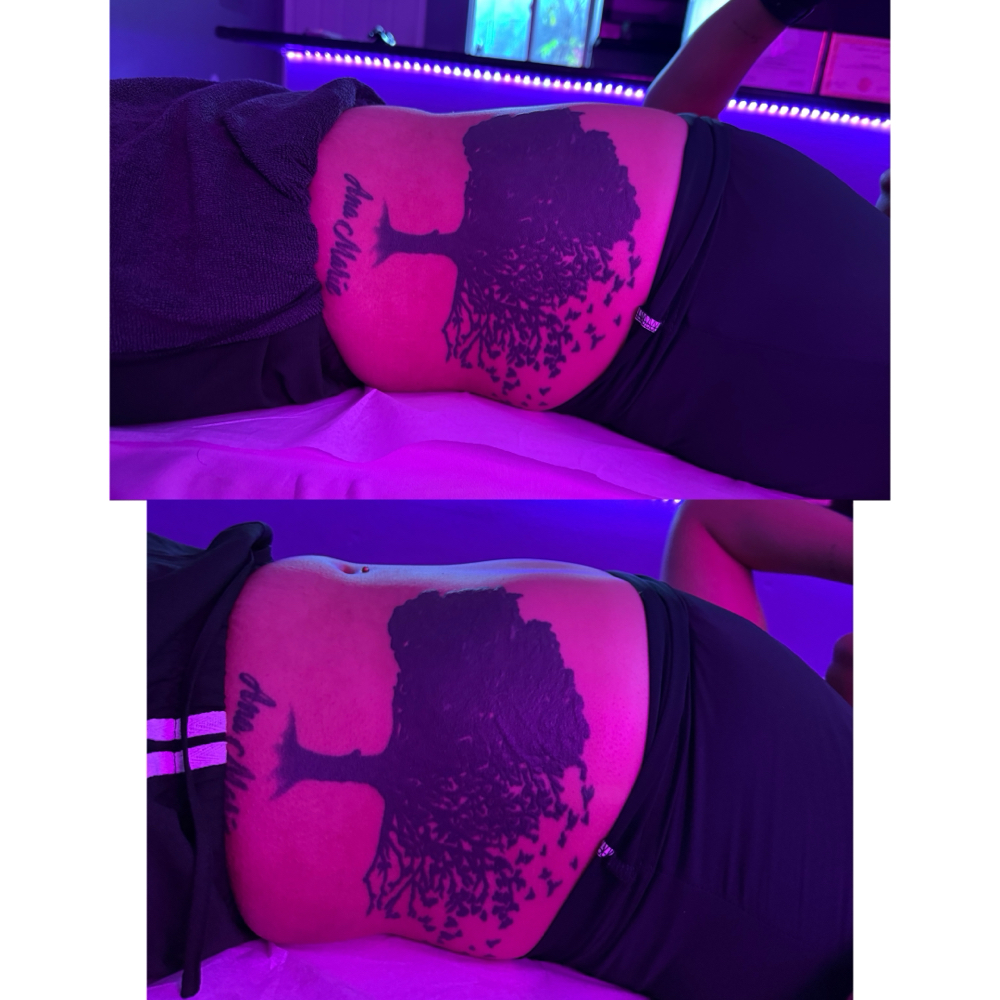 body slimming treament
