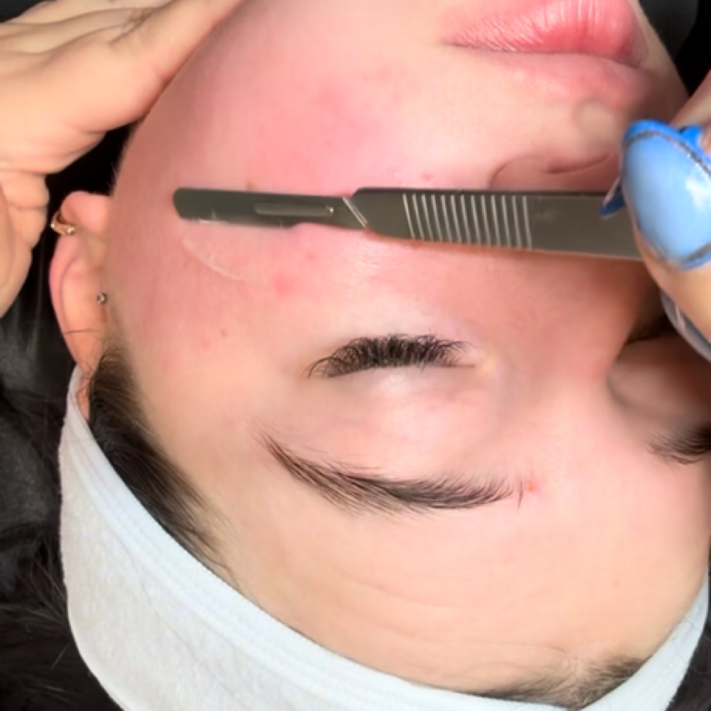 Dermaplane Facial at 10/10 Beauty - Kyla in Youngstown, OH