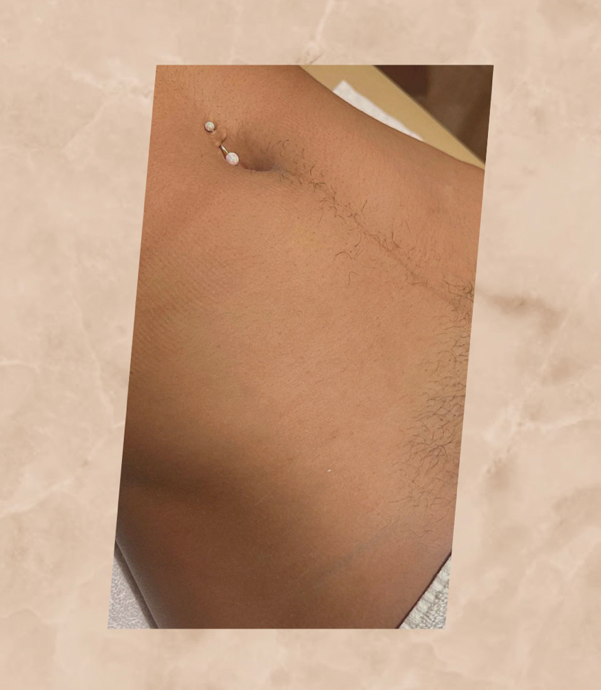 Tummy Trail