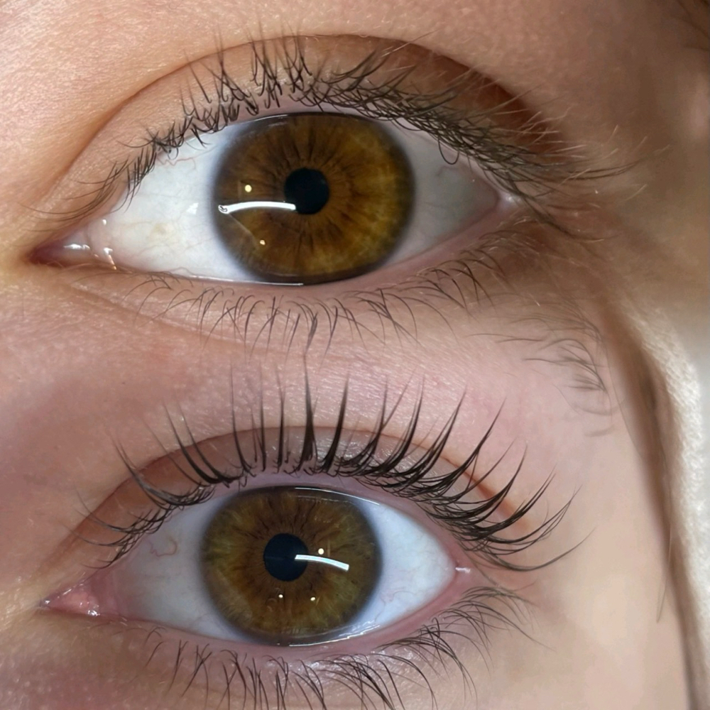 Tint Touch-Up at Beon Esthetics in Philadelphia, PA
