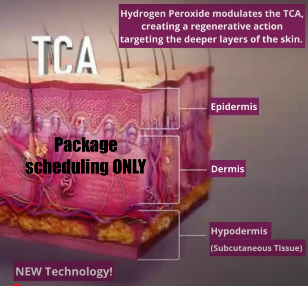 PRX-package Scheduling Only!