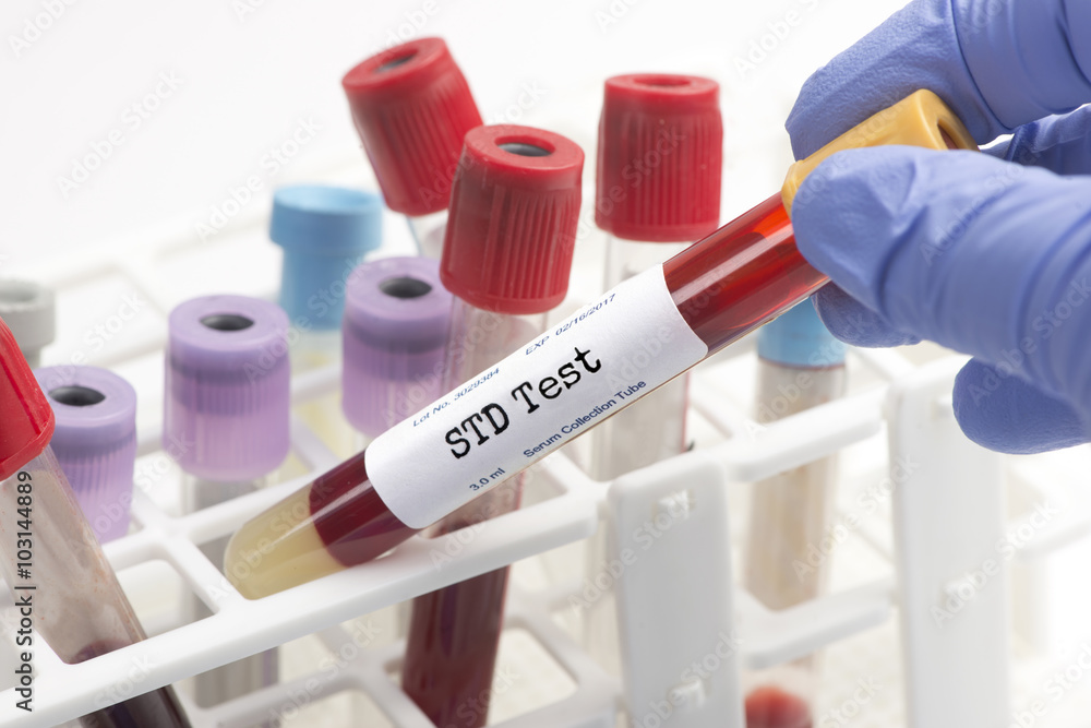 STD COMPREHENSIVE PANEL