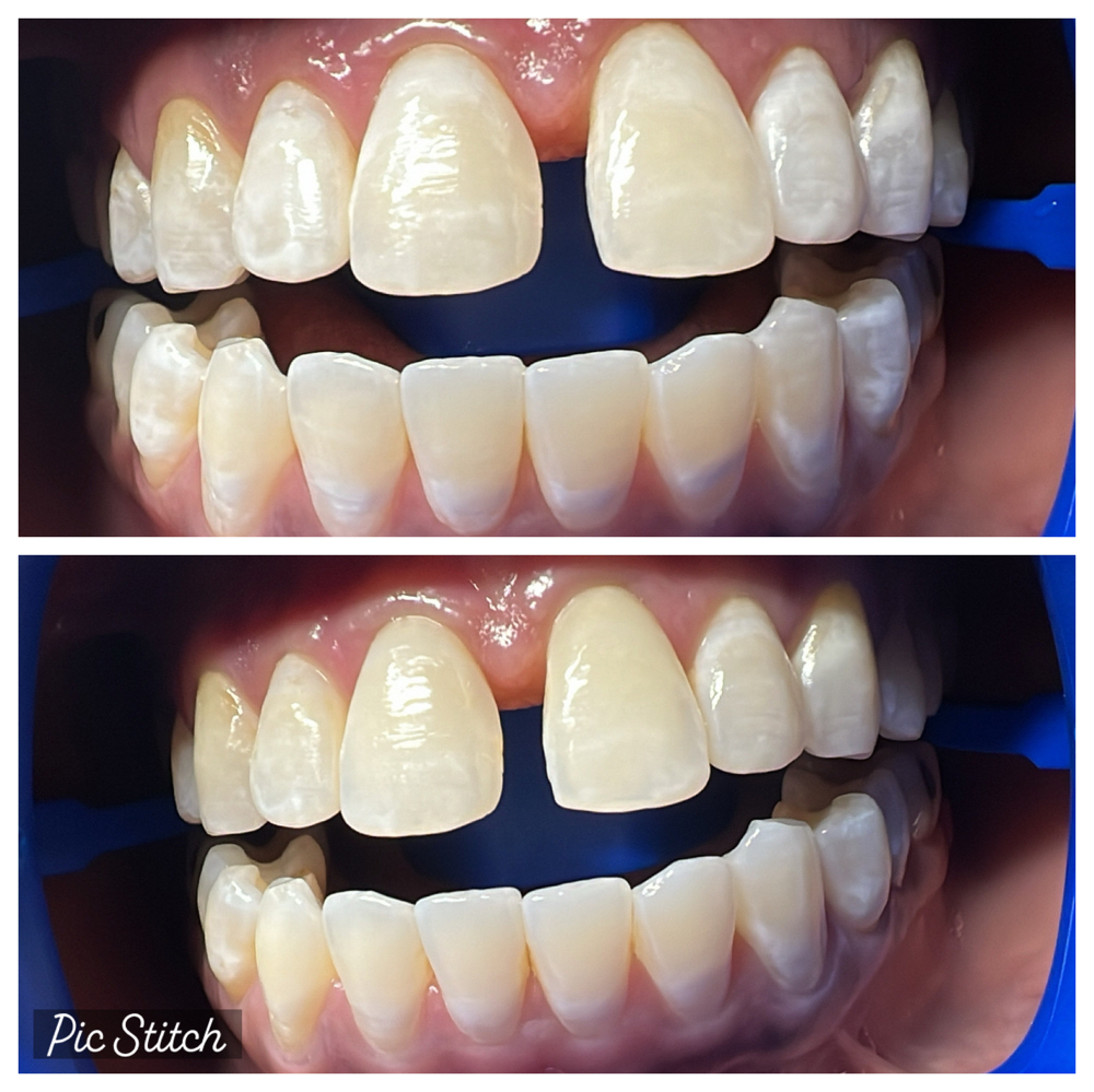 Routine Touch Up