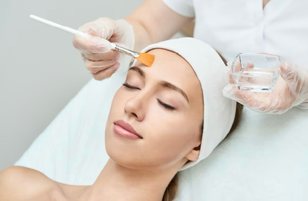 Chemical Peel