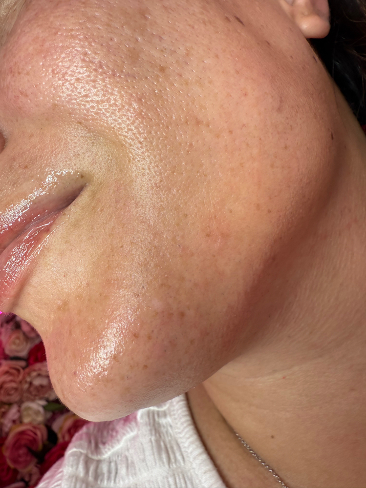Express Facial