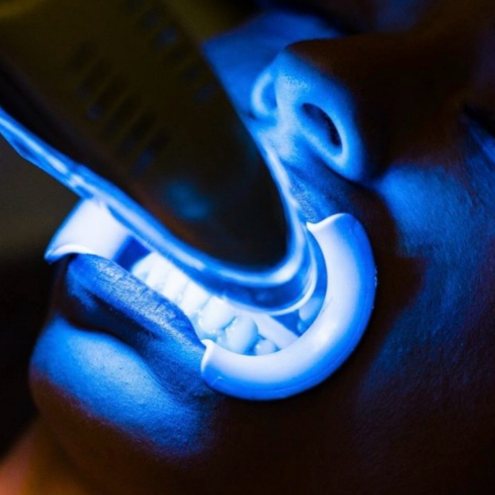 1 Hour Teeth Whitening Session at Lash Lounge in Cottage Grove, MN