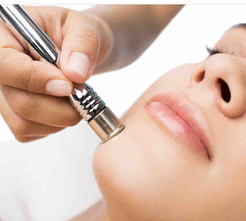 Microdermabrasion 1hr