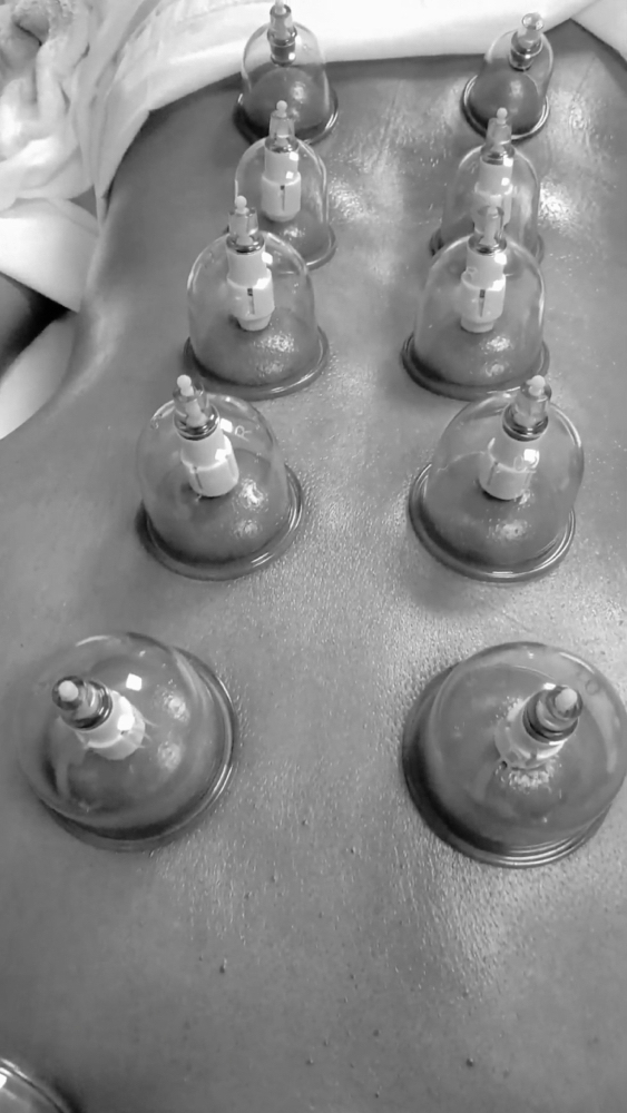 Lymphatic Cupping Vacuum Therapy