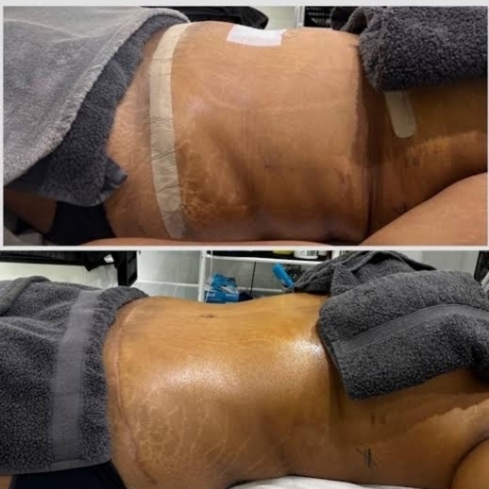 POST OP MASSAGE 10 at De lux beauty bar in New York, NY