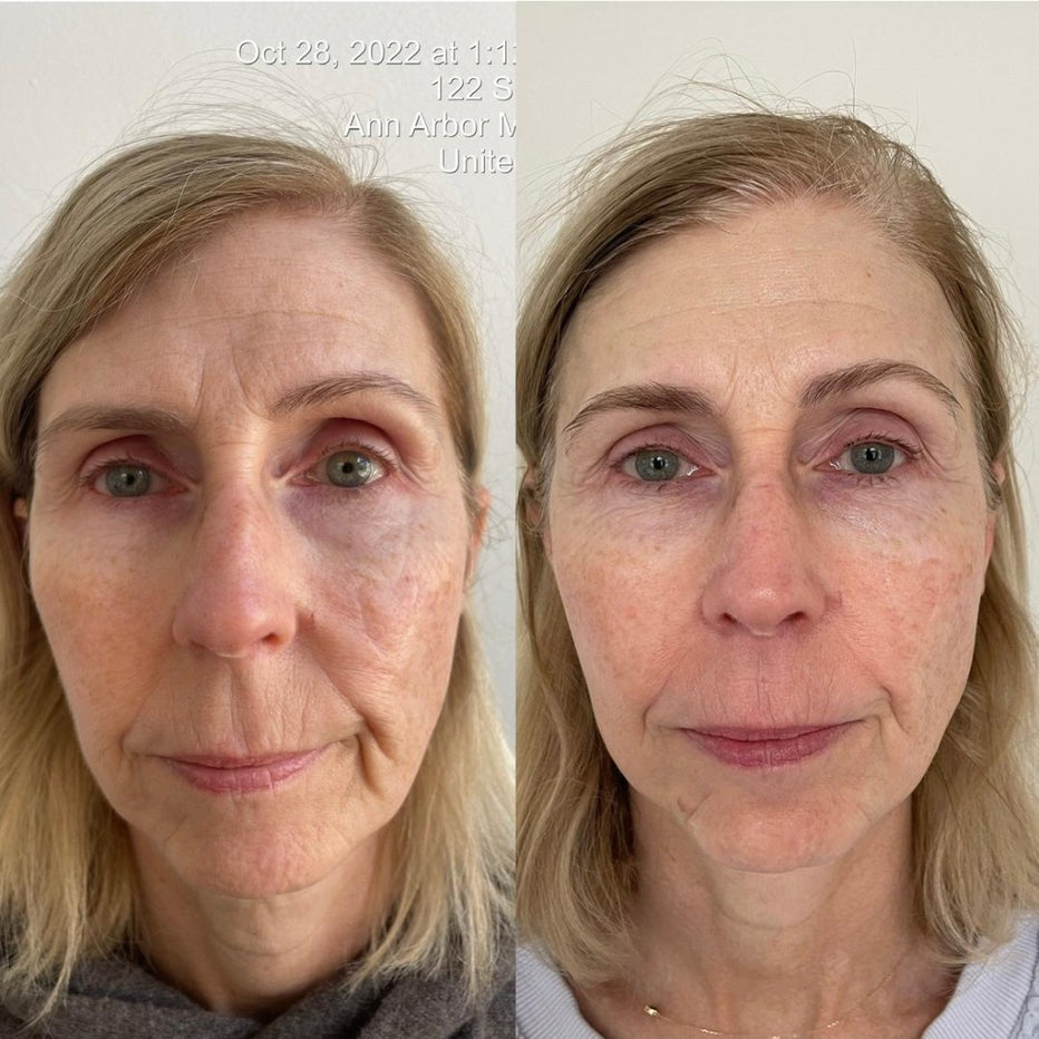 Skin Strategy Virtual Consult