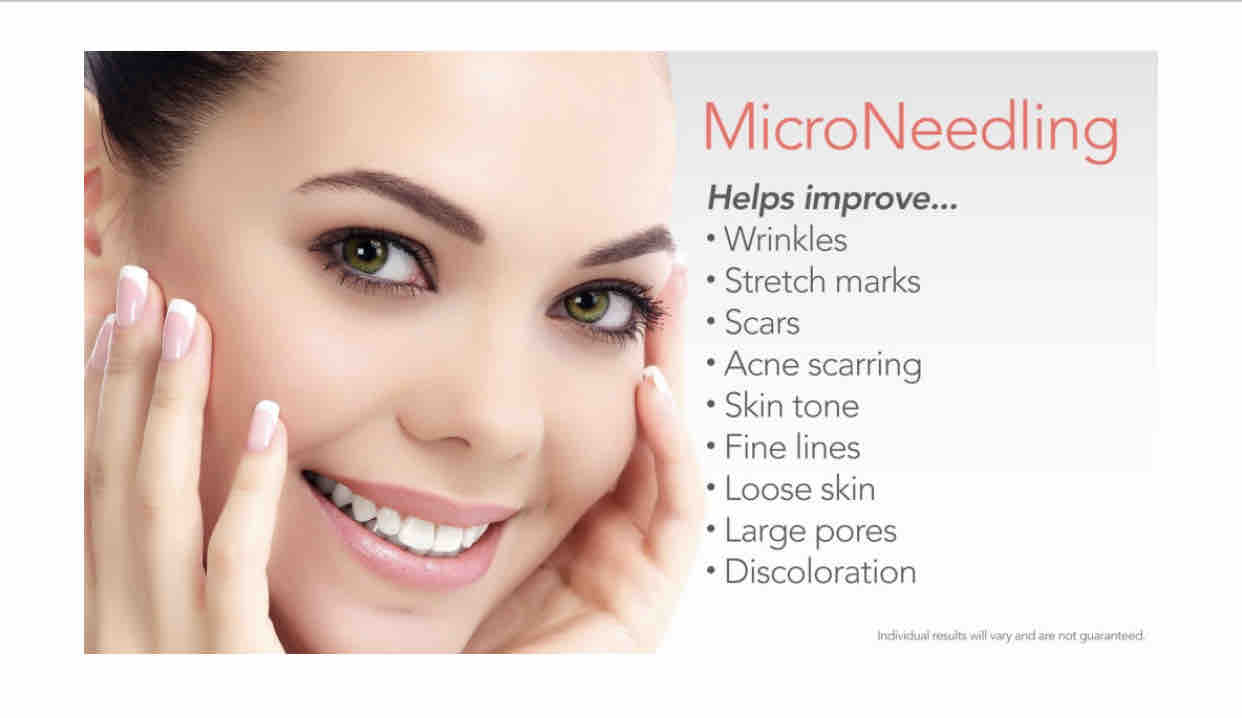 Microneedling Series (3)