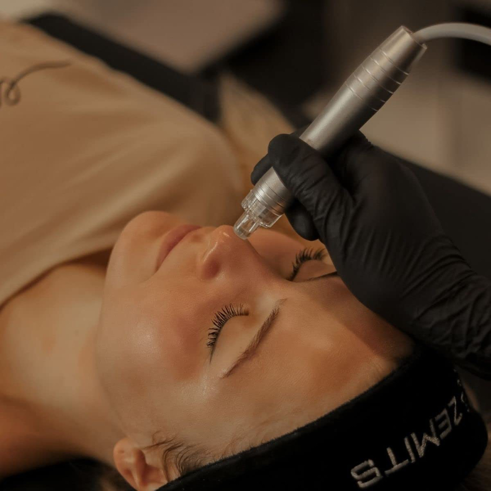 Hydrodermabrasion Facial