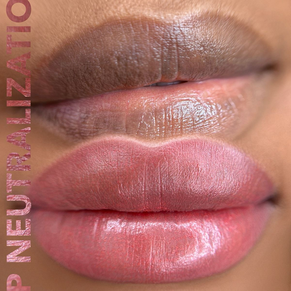 Lip Neutralization