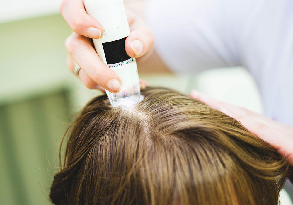 Hair Scalp Analysis