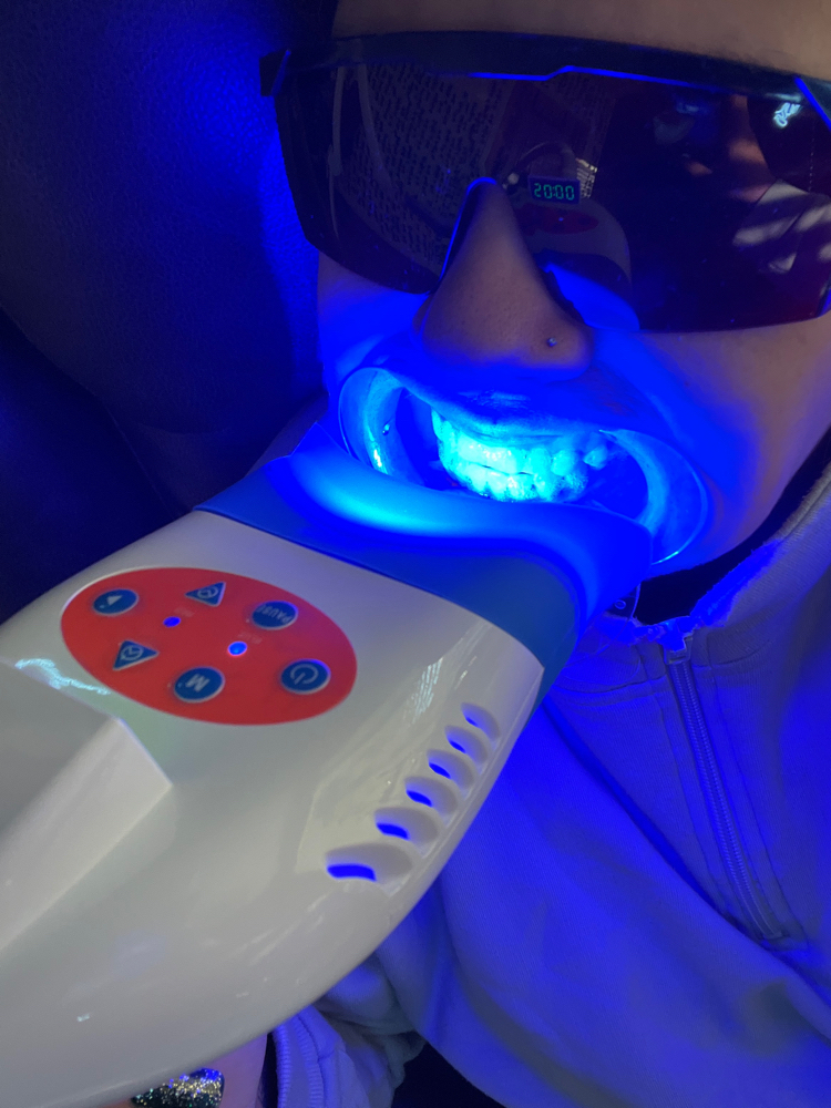 Laser Teeth Whitening- 1 Hour