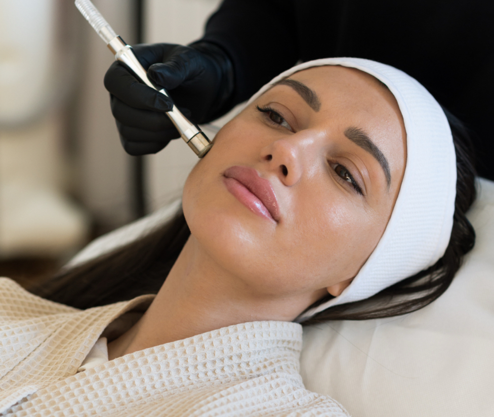 Add On- Microdermabrasion