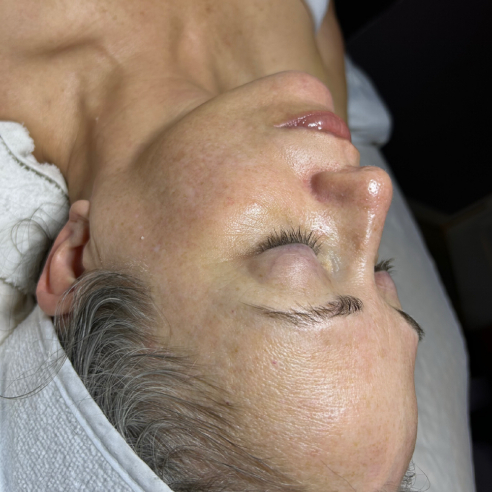 Advanced Chemical Peel 30 Minutes at Peyton Bustamante in Harrisburg, IL