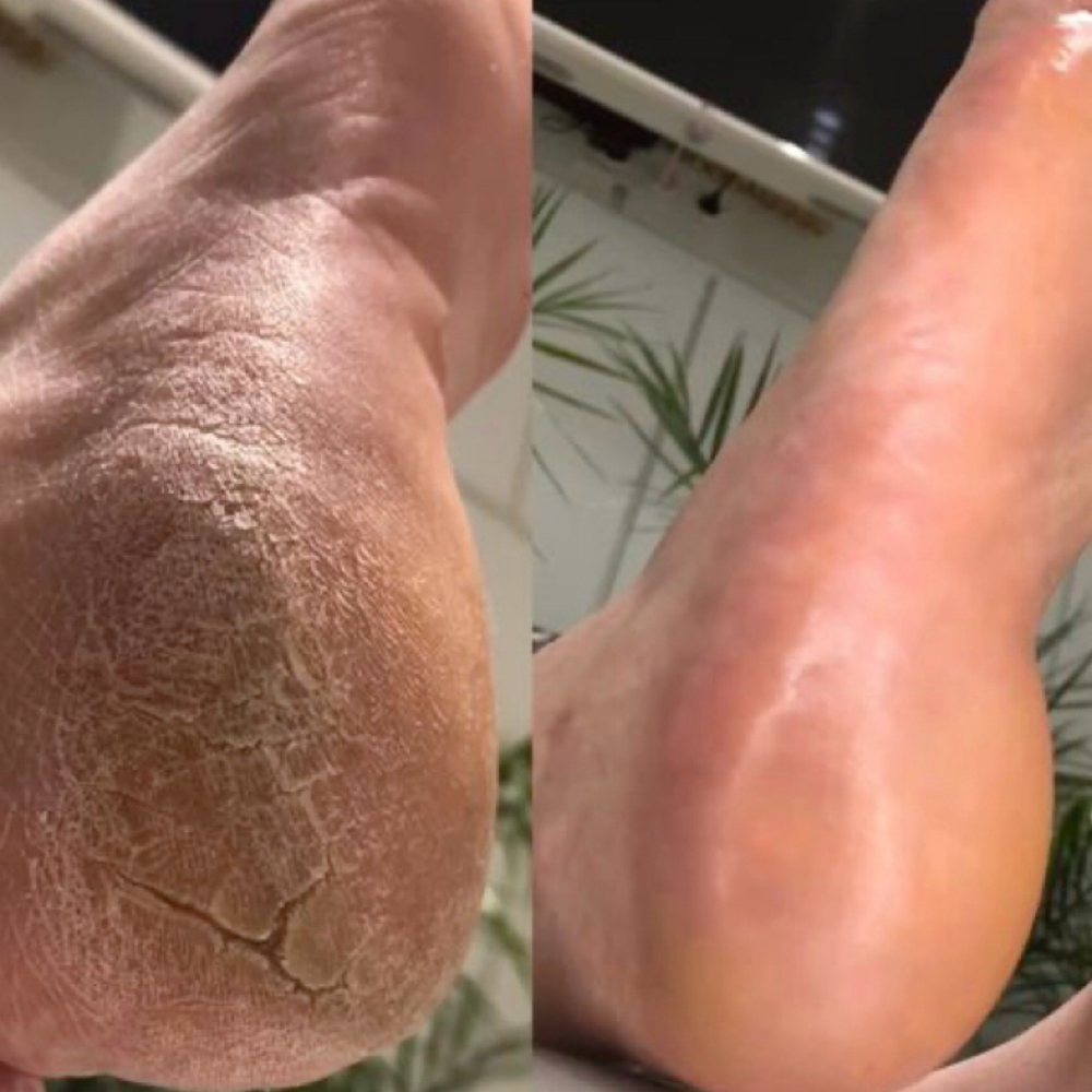 Foot Or Hands Callus Treatment at Kandys Glam Bar LLC in San Antonio, TX