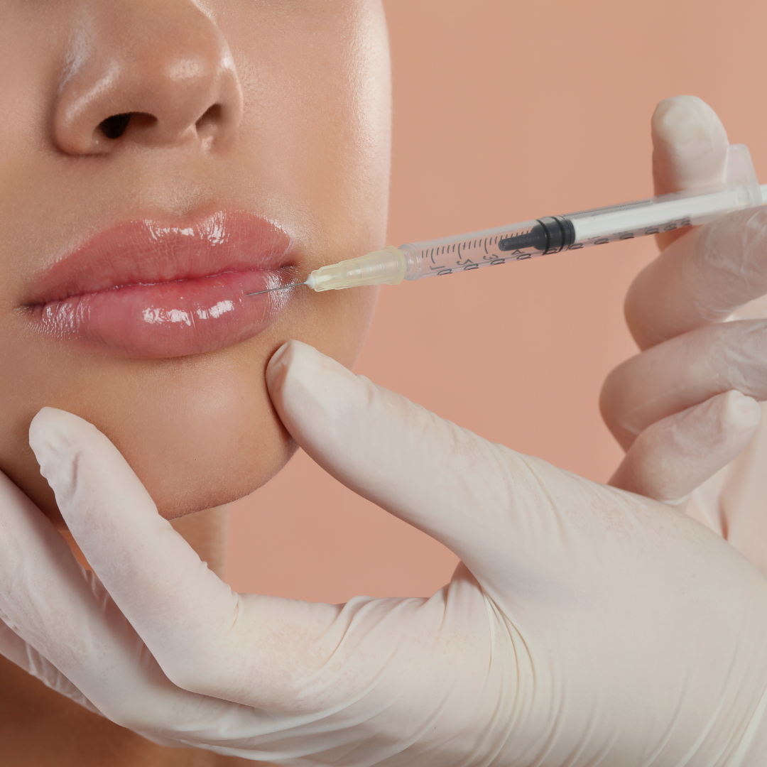 Lip Filler | Full Syringe