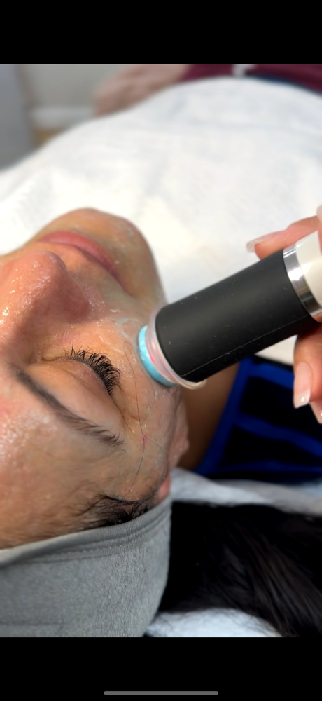 Geneo facial
