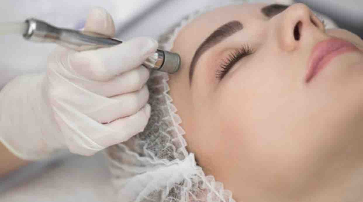 Microdermabraision with Diamond tip