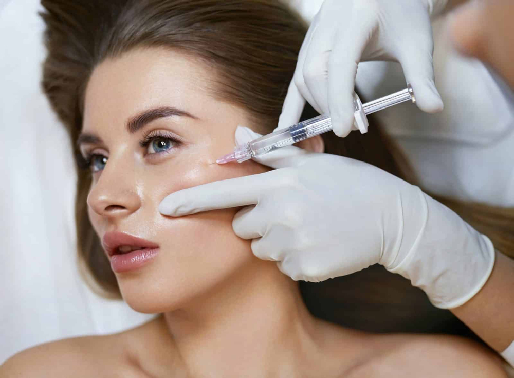 Facial Filler- multiple areas