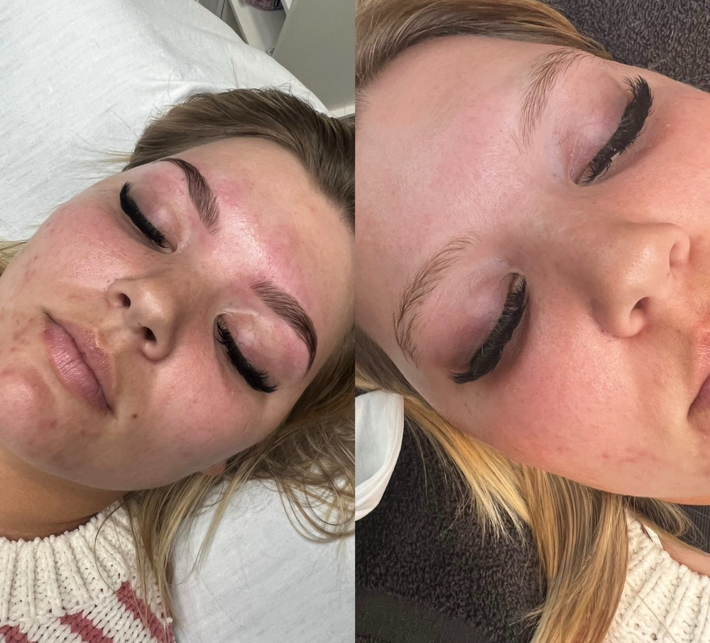 Brow Combo