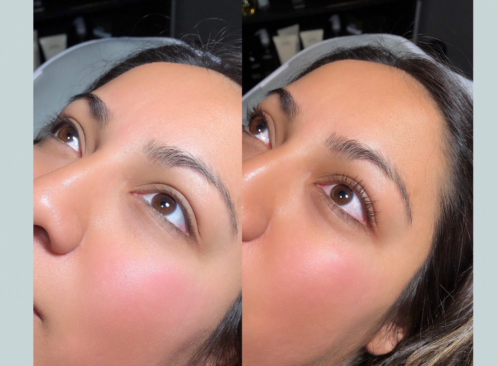 Lash Lift