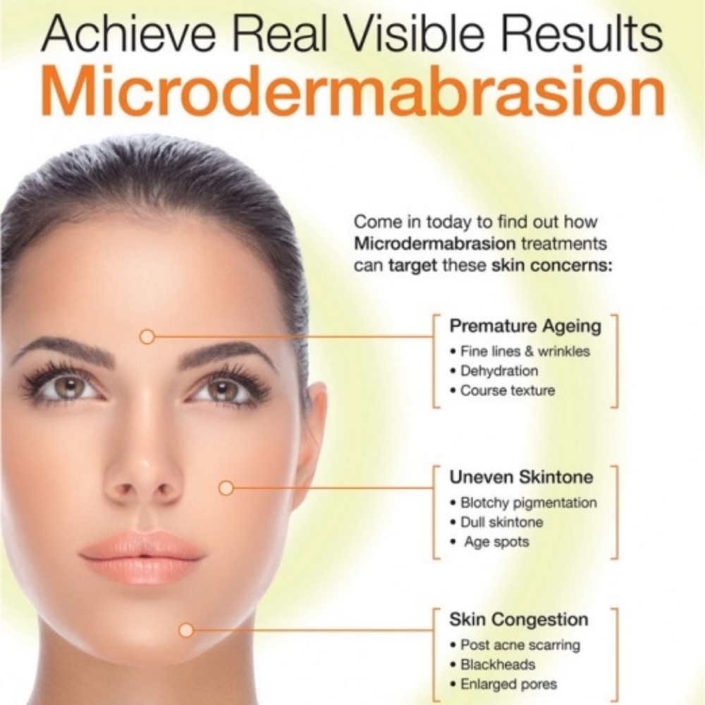 Microdermabrasion at Serifium Skincare by Monica in Brownsville, TX