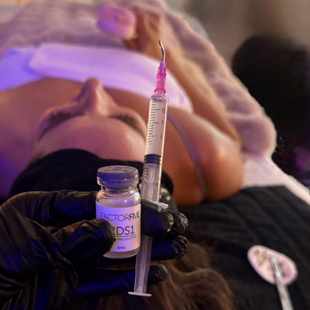 Factor five Peel+Dermaplane at E Aesthetics  and Acne Care in West Linn, OR