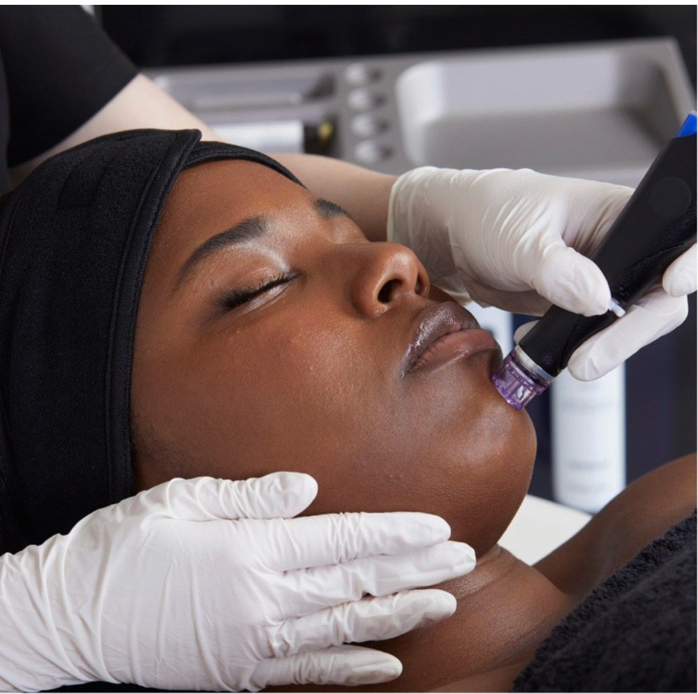 Hydra Facial