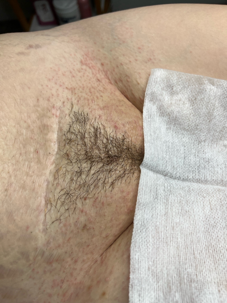 Bikini Wax at HAUS OF SKINN in Pasco, WA