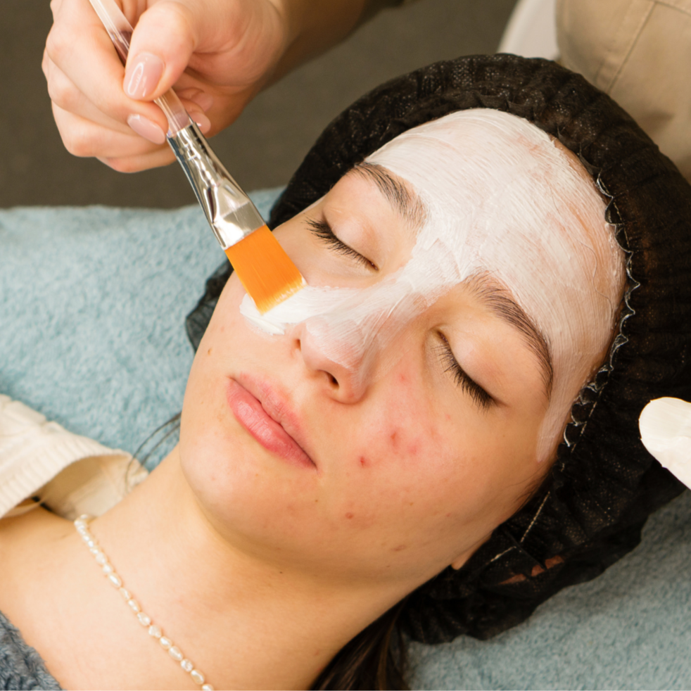 Teen Acne Facial