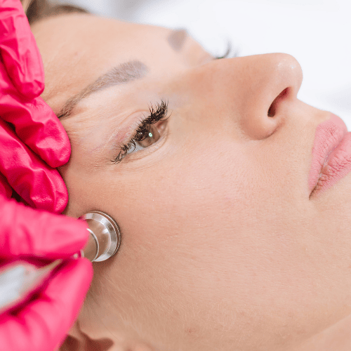 Microdermabrasion