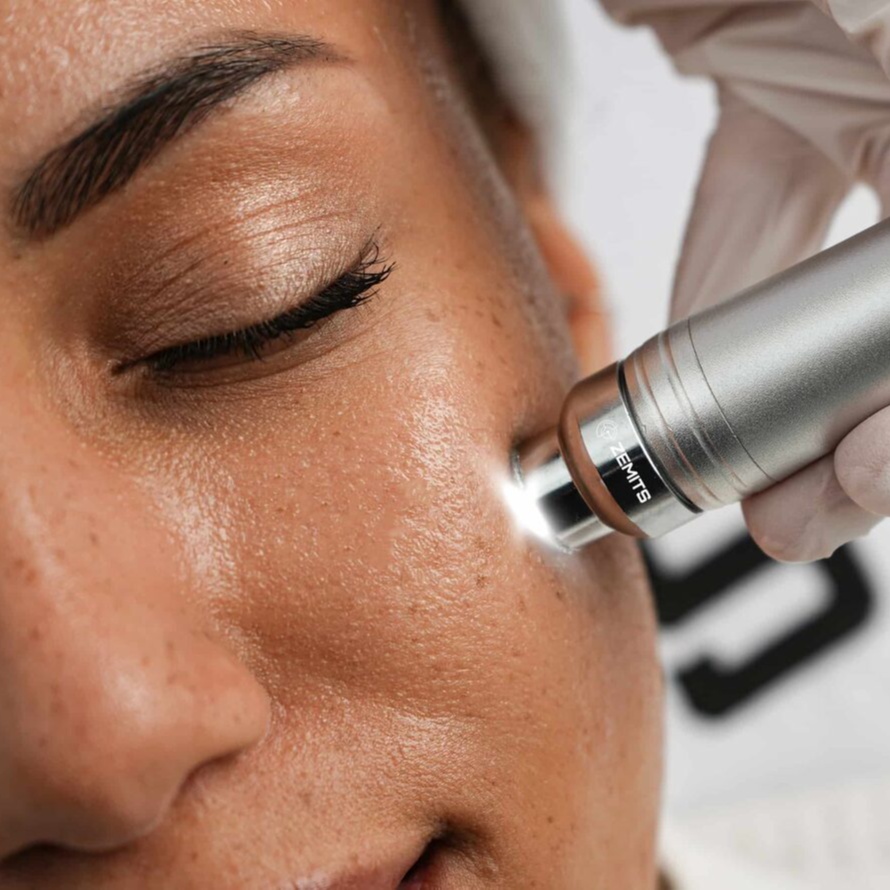 HydroDiamond Facial at Lumeva Aesthetic  L.L.C in Maryland, MD