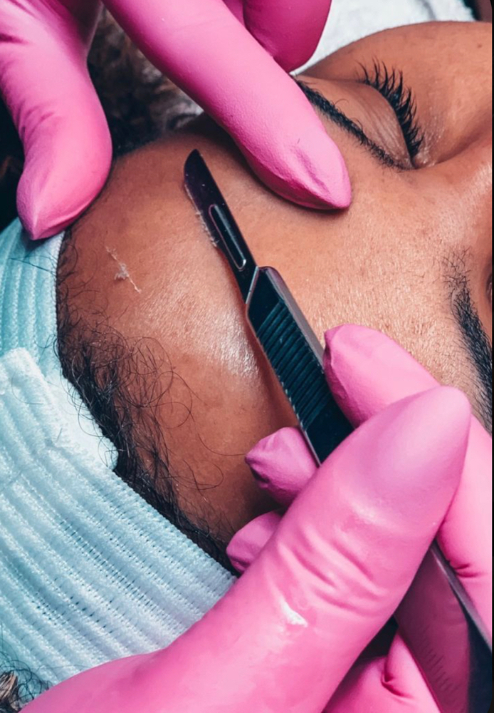 Dermaplane Facial