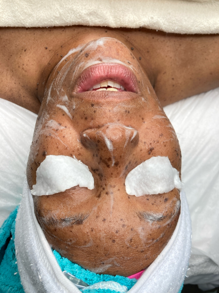EXPRESS FACIAL