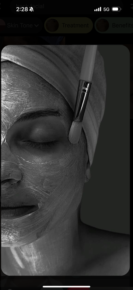 Microdermabrasion