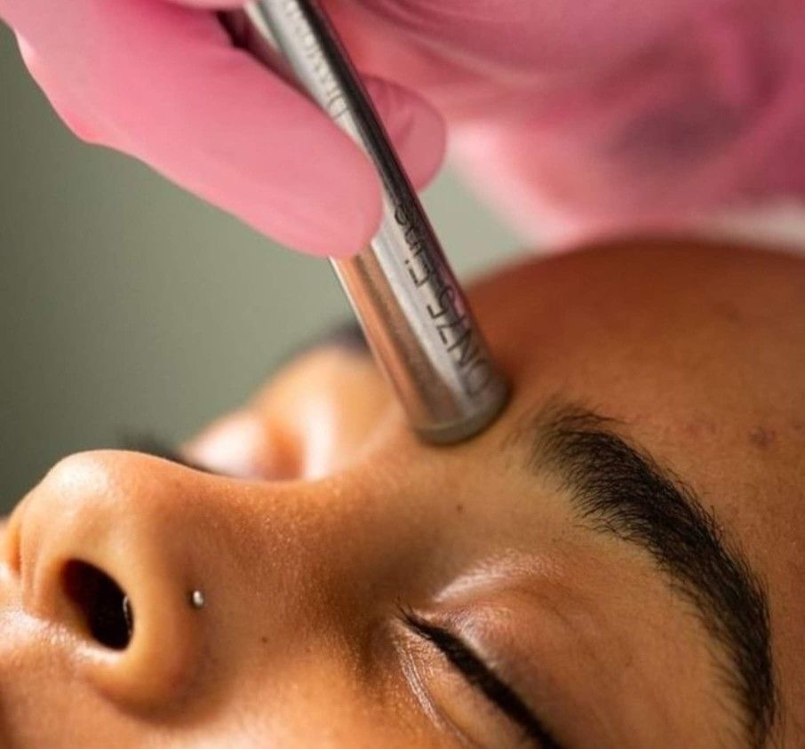 Microdermabrasion Facial