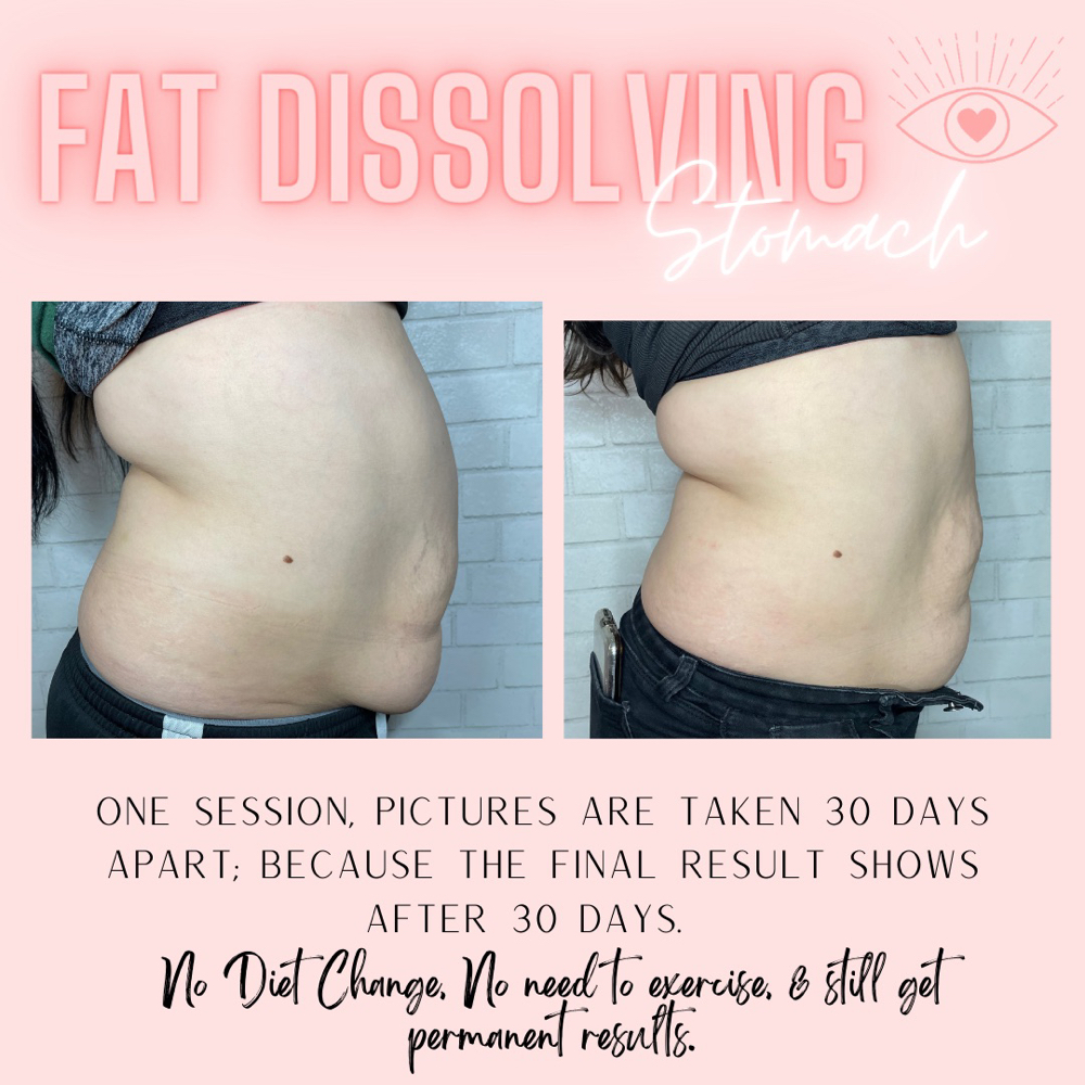 Fat dissolving Stomach