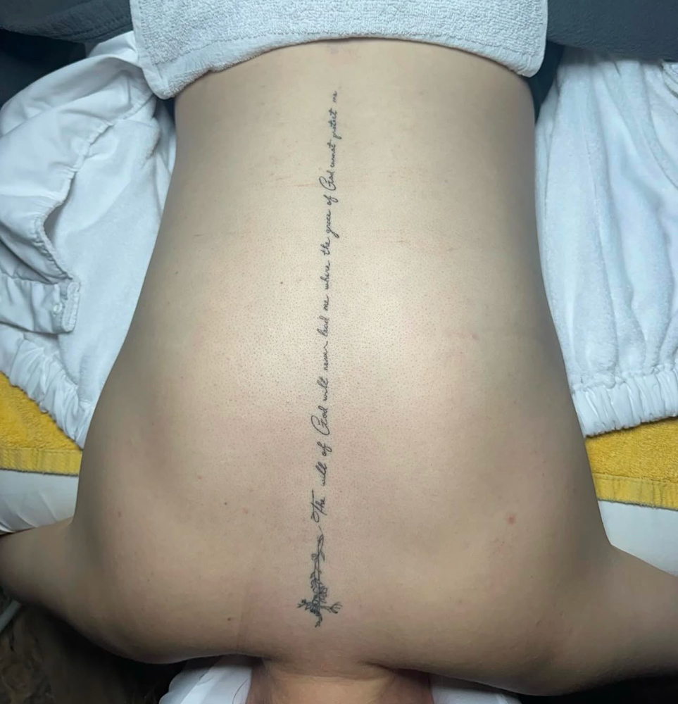 Back Treatment at BeYouthful Esthetics in Monticello, IL