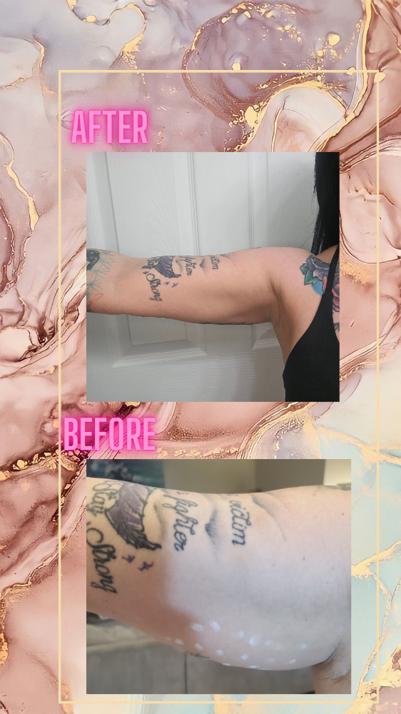 Tighten & Tone Arms And Bat Wings 3