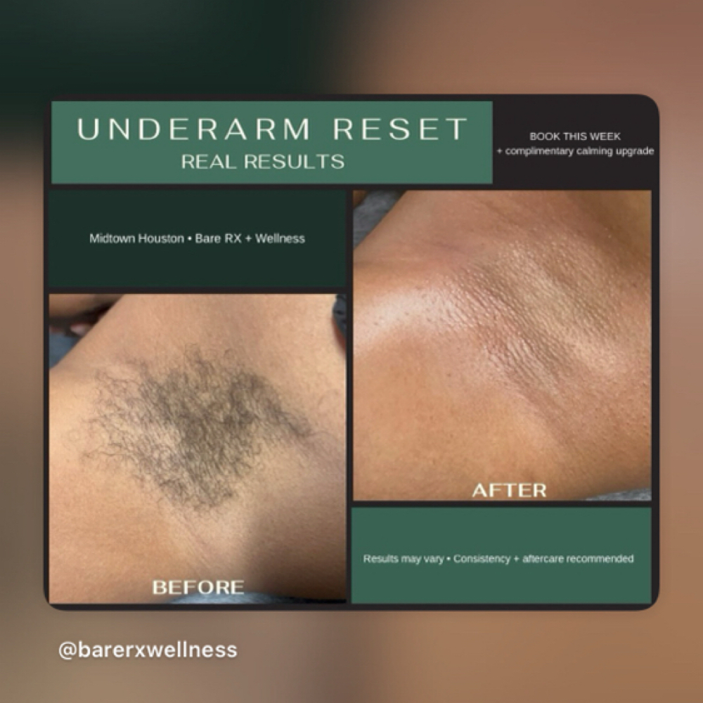Underarm Wax | Houston